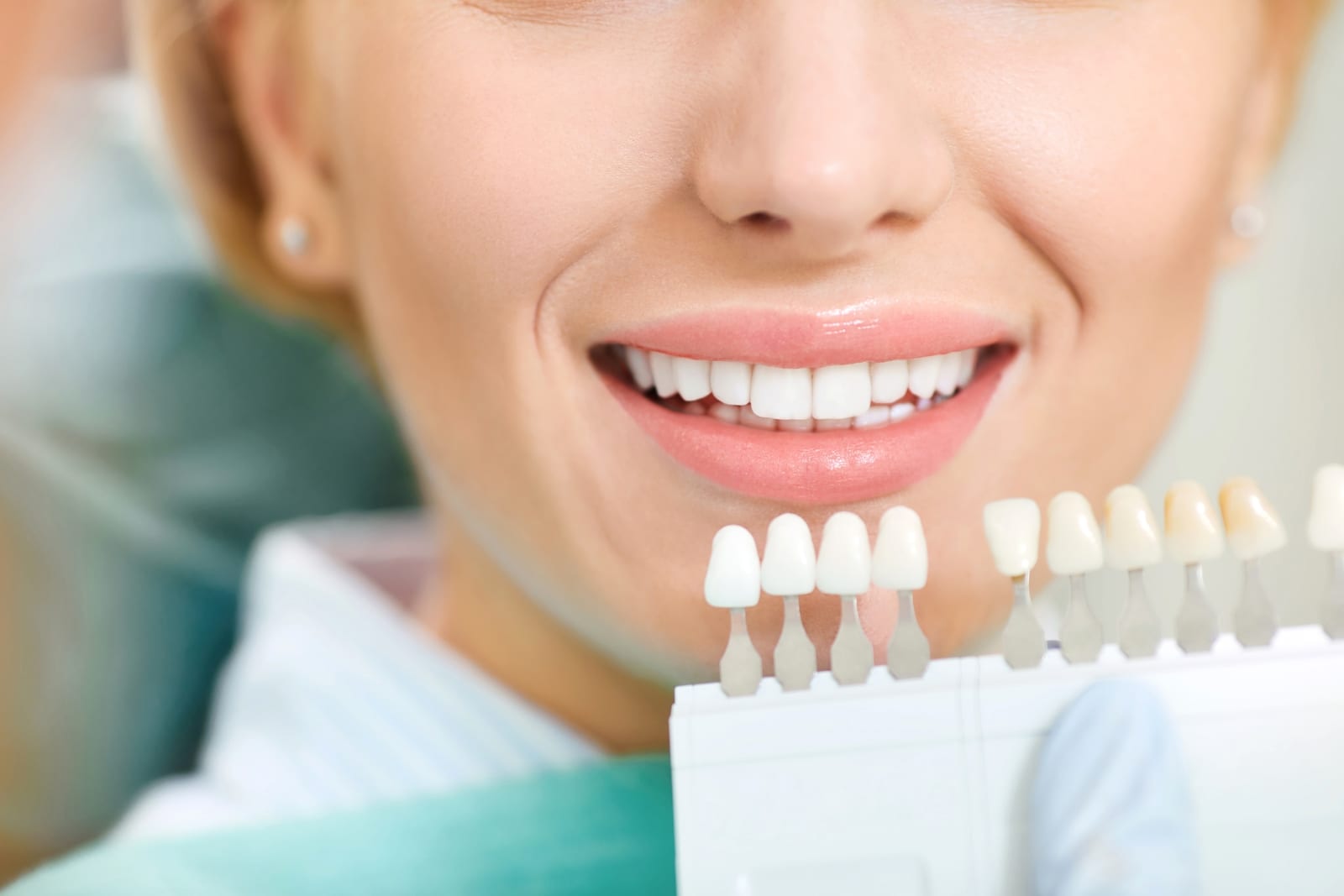 teeth whitening grants pass