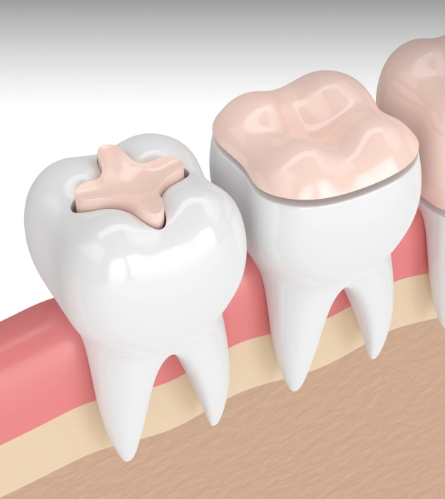 What is Periodontal Care?